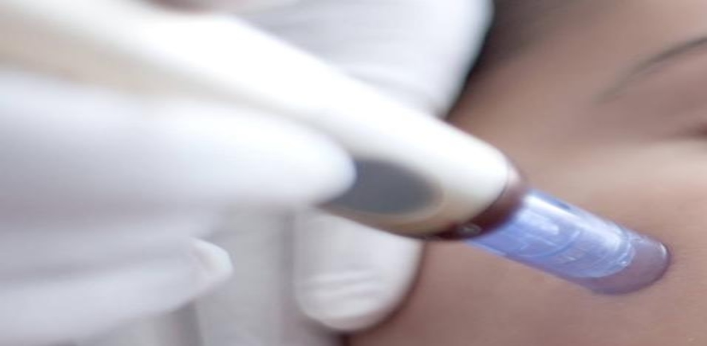 Mesotherapy